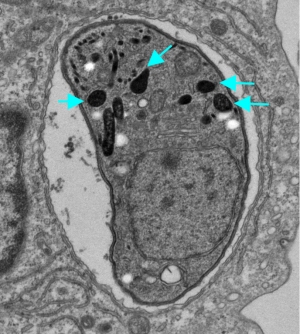宿主の細胞の中に感染しているトキソプラズマの電子顕微鏡写真。矢印の「デンスグラニュール（濃縮顆粒）」からGRAタンパク質が宿主細胞質に分泌される（大阪大学の発表資料より）