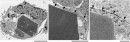 細胞質内にXpa結晶を抱えるHEK293細胞の透過型電子顕微鏡画像。スケールバー：（左）5ミクロン、（中） 0.2ミクロン、（右）0.1ミクロン。結晶を取り囲む膜構造を矢印で示している。（理化学研究所の発表資料より）