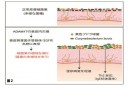 正常な皮膚とアトピー性皮膚炎の皮膚の違い（慶応大の発表資料より）