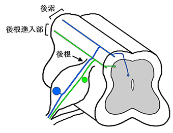 切断した脊髄の模式図で、図の上が背側で下が腹側。後根を通る痛覚神経突起（緑色）と固有感覚神経突起（青色）は、脊髄へ入ると分別される。痛覚神経突起は脊髄の外側部（後根進入部）を長軸方向に走行し、固有感覚神経突起は背側部（後索）を長軸方向に走行する。（理化学研究所の発表資料より）