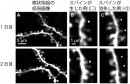 マーモセット大脳皮質のスパインの経時的変化。開発した手法でマーモセット大脳皮質のスパインの経時的なイメージングを行った。1日目と2日目の画像を比較すると図中の□部にはあらたなスパインが発生し、△部ではスパインが消失したことが分かる。(理化学研究所の発表資料より) マーモセット大脳皮質のスパインの経時的変化。開発した手法でマーモセット大脳皮質のスパインの経時的なイメージングを行った。1日目と2日目の画像を比較すると図中の□部にはあらたなスパインが発生し、△部ではスパインが消失したことが分かる。(理化学研究所の発表資料より)