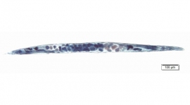 宇宙から帰還した線虫を脂質染色した写真(東北大 東谷研究室) 宇宙から帰還した線虫を脂質染色した写真(東北大 東谷研究室)