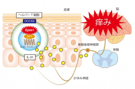 アトピー性皮膚炎における「かゆみ」発生のイメージ図。（画像：九州大学発表資料より）