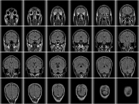 radikoがラジオ聴取と脳の成長の関係をMRI脳画像診断を用いて解明。ラジオを聴き続けることで記憶系脳が最大で2.4倍、聴覚系・理解系脳が最大で2倍成長