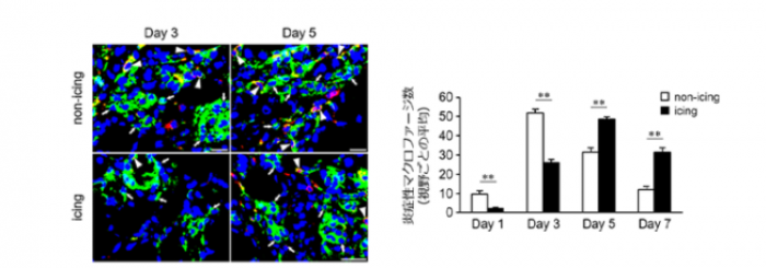 アイシングは筋損傷後の回復を遅らせる　神戸大らの研究