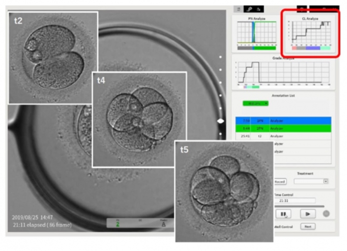 DNP、体外受精卵の発育確認をAIによる画像解析でサポート
