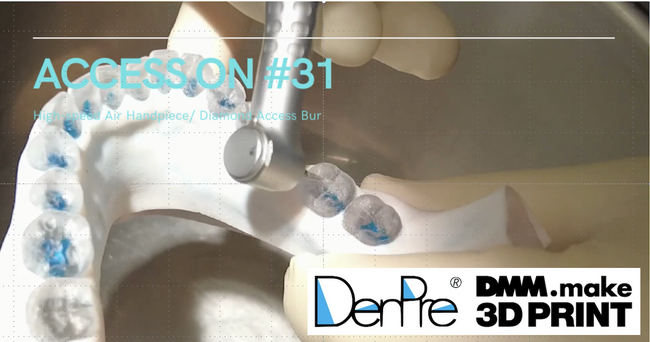 DMM.make 3DプリントとDental Predictionが業務提携開始