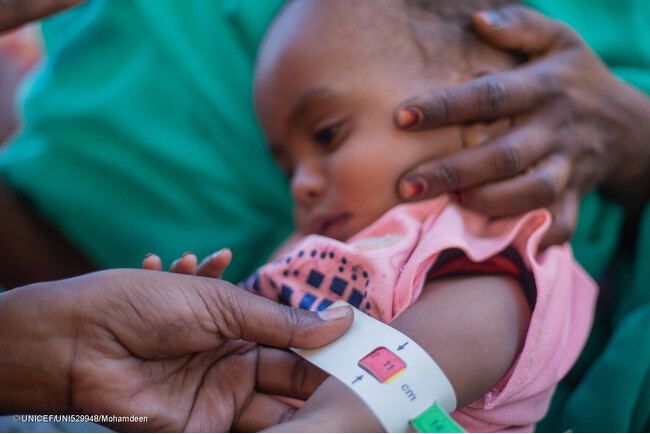 飢饉の危機にあるスーダン：栄養不良で死亡する子どもが急増【プレスリリース】