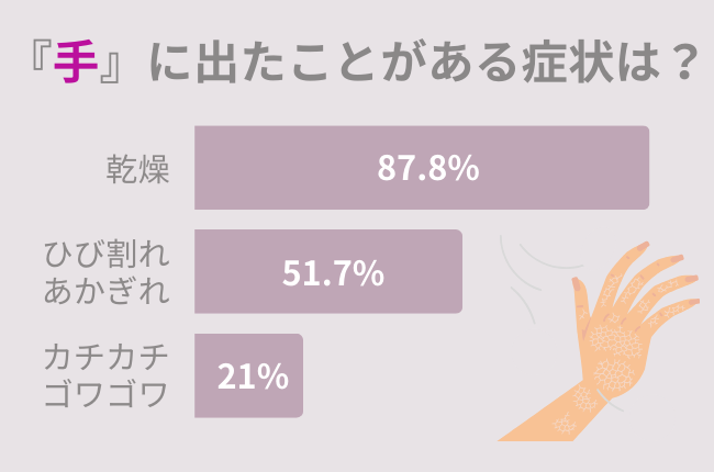 40代女性必見！87.8％の女性が『手の乾燥』を経験した事アリ。手荒れを改善するハンドクリームの選び方とは。