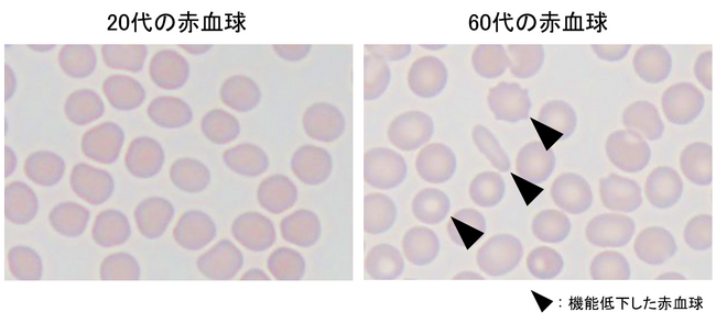 加齢に伴う疲れやすさに赤血球の機能低下が関与することを発見