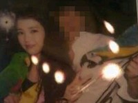 歌手IU（アイユ）が、日本のミュージックビデオ撮影中にオウムに噛まれていたことが遅ればせながら伝えられた。