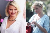 海外セレブ・モデルの気になるBefore&After