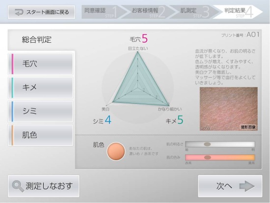 肌解析の出力イメージの一例 (総合判定)(画像:ソニー) 肌解析の出力イメージの一例 (総合判定)(画像:ソニー)