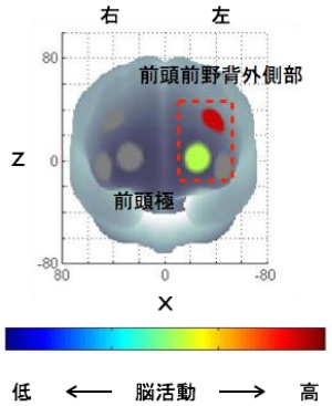 軽強度の運動によって活動が高まった脳の部位を示す図(筑波大学と中央大学の発表資料より) 軽強度の運動によって活動が高まった脳の部位を示す図(筑波大学と中央大学の発表資料より)