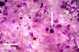 実際に着用したマスクに付着したスギ花粉（矢印）の光学顕微鏡写真（濾紙上に集めてヨウ素で着色したもの）。左下の白線は100マイクロメートルの大きさを表す（東京大学の発表資料より）