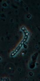 Calyculin Aを生産するバクテリアEntotheonella sp.（東京大学の発表資料より）