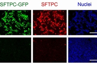 （左）II型肺胞上皮細胞に分化するとGFPが光るヒトiPS細胞を作成し、3次元培養で光ることを証明した。（右）GFP陽性細胞と陰性細胞をそれぞれ単離するとGFPとSFTPCが高い一致率であることがわかった（京都大学の発表資料より）
