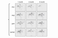 4種類のアルツハイマー病モデルマウスにおける病態ネットワークの時間経過による変化（東京医科歯科大学の発表資料より）