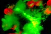 真皮樹状細胞とエフェクターT細胞の集簇（左）と、血管周囲に集簇する真皮樹状細胞とマクロファージ（右）（京都大学の発表資料より）