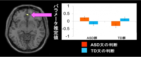 ASD群がASD文を判断し、TD群がTD文を判断する際に、腹内側前頭前野が有意に活動した（京都大学の発表資料より）