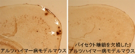 マウス脳におけるアミロイドβの染色像。（左）アルツハイマー病モデルマウス、（右）バイセクト糖鎖を欠損させたアルツハイマー病モデルマウス（理化学研究所の発表資料より）