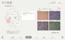 ソニーが開発した肌解析システム「BeautyExplorer」の結果表示画面(毛穴)(写真提供:ソニー) ソニーが開発した肌解析システム「BeautyExplorer」の結果表示画面(毛穴)(写真提供:ソニー)