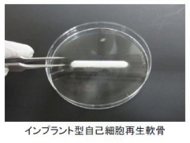 富士ソフトは、「インプラント型自己細胞再生軟骨」の企業治験を4月に開始する（写真：同社発表資料より）