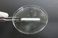 富士ソフトは、「インプラント型自己細胞再生軟骨」の企業治験を4月に開始する（写真：同社発表資料より）