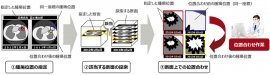 画像比較による腫瘍の経時変化の観察(富士通研究所の発表資料より) 画像比較による腫瘍の経時変化の観察(富士通研究所の発表資料より)