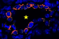 GDNFシグナルが細胞に伝わらない遺伝子改変マウスの精巣。これまではGDNFシグナルに異常があると精子幹細胞は生存・増殖・精子形成ができないとされていた（丸印：生殖細胞がない精細管。精子幹細胞～精子までのすべての生殖細胞がなく、セルトリ細胞だけが残っている）。しかし、一部の精細管で精子幹細胞マーカーCDH1陽性の細胞が集団で生存していることが見い出された（星印：赤色は精子幹細胞のマーカーCDH1で染色された部分）（京都大学の発表資料より）