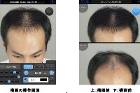 15日からサービス開始の「アデランス ヘアシミュレーション」（同社発表資料から）