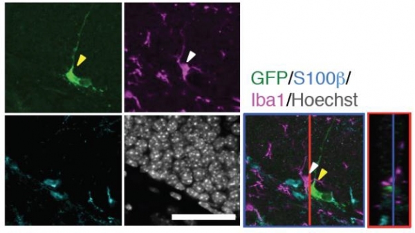 海馬に存在するミクログリア(紫)は神経幹細胞(緑)と隣接して存在している（九州大学の発表資料より）