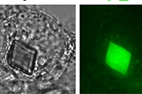 HEK293細胞の細胞質にできたXpaタンパク質の結晶。スケールバーは5ミクロン。T：透過画像。FL：蛍光画像。Merge： TとFLを重ね合わせた画像（理化学研究所の発表資料より）