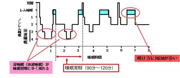 一晩の睡眠パターンを示す図。Stage1-4のノンレム睡眠は脳を休息させる睡眠で眠りの20-25%を占め、特にstage3-4の徐波睡眠は熟眠感が得られる質の高い睡眠といわれている。一方、レム睡眠を睡眠の75-80%を占め、体を休息させる睡眠といわれている。徐波睡眠の役割として、脳の休息以外に交感神経活動の低下とともに副交感神経活動の上昇が見られ、夜間の血圧低下や血糖コントロールの改善が起きるといわれている。(大阪市立大の発表資料より) 一晩の睡眠パターンを示す図。Stage1-4のノンレム睡眠は脳を休息させる睡眠で眠りの20-25%を占め、特にstage3-4の徐波睡眠は熟眠感が得られる質の高い睡眠といわれている。一方、レム睡眠を睡眠の75-80%を占め、体を休息させる睡眠といわれている。徐波睡眠の役割として、脳の休息以外に交感神経活動の低下とともに副交感神経活動の上昇が見られ、夜間の血圧低下や血糖コントロールの改善が起きるといわれている。(大阪市立大の発表資料より)