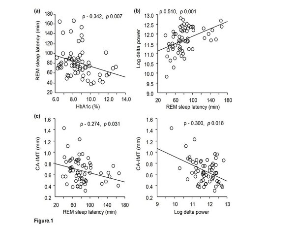 睡眠指標(レム睡眠潜時、ログデルタパワー)とHbA1c・頸動脈内膜中膜肥厚度との相関を示す図。血糖コントロール指標「HbA1c」は、睡眠時無呼吸症候群の指標である無呼吸・低呼吸インデックス(AHI)と独立してREM睡眠潜時と有意の負の関連を示した。これは、血糖コントロール増悪を示すHbA1cの上昇が、深睡眠指標であるレム睡眠潜時の短縮をもたらすことを示唆する結果だった。(大阪市立大の発表資料より) 睡眠指標(レム睡眠潜時、ログデルタパワー)とHbA1c・頸動脈内膜中膜肥厚度との相関を示す図。血糖コントロール指標「HbA1c」は、睡眠時無呼吸症候群の指標である無呼吸・低呼吸インデックス(AHI)と独立してREM睡眠潜時と有意の負の関連を示した。これは、血糖コントロール増悪を示すHbA1cの上昇が、深睡眠指標であるレム睡眠潜時の短縮をもたらすことを示唆する結果だった。(大阪市立大の発表資料より)