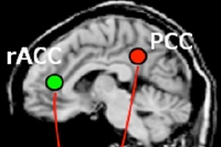 攻め／守りの戦略決定に関わる脳ネットワーク。与えられた盤面での攻めの主観的価値が後帯状皮質（PCC）に、守りの主観的価値が前帯状皮質唯側部（rACC）にそれぞれ表現され、前頭前野背外側部（DLPFC）に伝えられてその差によって攻めるか守るかの戦略が決定される。（理研の発表資料より）