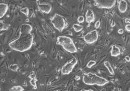 樹立・維持された領域選択型マウスエピ幹細胞のコロニー（近畿大の発表資料より）