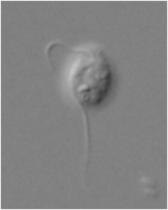 多様なグループを含むストラメノパイル生物群の最も初期に枝分かれしたと見られる新種の原生生物「Platysulcus tardus」の光学顕微鏡写真。2本の鞭毛があり、基質上を這って進む(筑波大学の発表資料より) 多様なグループを含むストラメノパイル生物群の最も初期に枝分かれしたと見られる新種の原生生物「Platysulcus tardus」の光学顕微鏡写真。2本の鞭毛があり、基質上を這って進む(筑波大学の発表資料より)