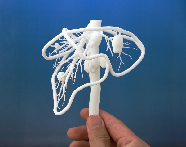 大日本印刷と筑波大学が開発した内部構造が見えやすい臓器立体模型（大日本印刷の発表資料より）