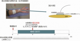 今回の研究で実施した実験の手順を示す図。化学物質ヒスタミンを電気刺激で皮膚へ浸透させることで、痒みを誘発した。痒み刺激中にtDCSを施行し、対象者の主観的痒み知覚(9段階)を30秒ごとに聴取した。(生理学研究所の発表資料より) 今回の研究で実施した実験の手順を示す図。化学物質ヒスタミンを電気刺激で皮膚へ浸透させることで、痒みを誘発した。痒み刺激中にtDCSを施行し、対象者の主観的痒み知覚(9段階)を30秒ごとに聴取した。(生理学研究所の発表資料より)