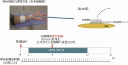 今回の研究で実施した実験の手順を示す図。化学物質ヒスタミンを電気刺激で皮膚へ浸透させることで、痒みを誘発した。痒み刺激中にtDCSを施行し、対象者の主観的痒み知覚（9段階）を30秒ごとに聴取した。（生理学研究所の発表資料より）