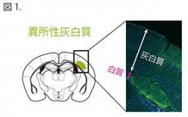 子宮内胎児脳電気穿孔法によって3種の遺伝子をそれぞれ導入することにより、マウスの脳の体性感覚野に異所性灰白質を作ることに成功した。左はマウスの脳の断面図のイラストで異所性灰白質（緑）が形成された場所を示す。右は異所性灰白質（緑色
の細胞を含む塊）が白質内に位置していることを示している。（慶應義塾大学の発表資料より）
