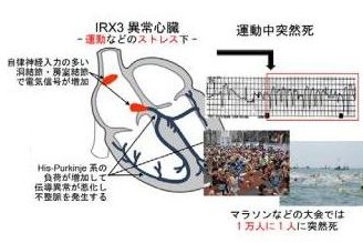 IRX3異常心臓のイメージ図（東京医科歯科大学発表資料より）