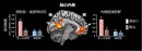 オレンジ色の部分は、悲しみ表情と涙による相乗効果を示した脳部位を表す。内側前頭前野と楔前部・後部帯状回は、悲しみ表情と涙が統合した時に強く活動した。棒グラフは相乗効果を示した脳部位の活動量を図示している。（生理学研究所の発表資料より）