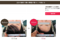 小顔になる広告の表示例（消費者庁発表資料より）