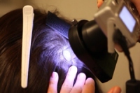 頭皮環境改善の臨床試験（シャープ発表資料より）