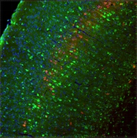ゲノム編集した成体マウスの脳の一部の染色写真（写真:理化学研究所の報道資料より）