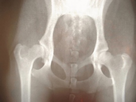 マーケティングリサーチを提供する総合企画センター大阪は、骨粗鬆症治療での薬剤処方状況や現場での薬剤の評価を明らかにすることを目的として、骨粗鬆症患者50人以上を担当し、副甲状腺ホルモン(PTH)製剤または抗体製剤を処方しているドクター30名に対してインタビュー調査を実施した。 マーケティングリサーチを提供する総合企画センター大阪は、骨粗鬆症治療での薬剤処方状況や現場での薬剤の評価を明らかにすることを目的として、骨粗鬆症患者50人以上を担当し、副甲状腺ホルモン(PTH)製剤または抗体製剤を処方しているドクター30名に対してインタビュー調査を実施した。