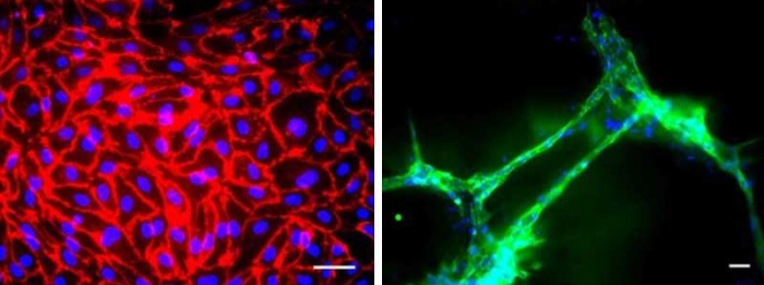 ヒトiPS細胞から作製した血管内皮細胞（京都大学の報道資料より）
