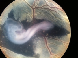 再生医療にも有用となる体組織の形成過程を知るには、発生過程で組織全体がどのように変形するのかを定量的に理解する必要がある。しかし、複雑な組織をリアルタイムかつ高分解能で計測することが難しいことから、従来の発生生物学では、各器官の発生に必須となる遺伝子や形態異常を引き起こす原因遺伝子に焦点を当てた子生物学的アプローチがとられてきた。 再生医療にも有用となる体組織の形成過程を知るには、発生過程で組織全体がどのように変形するのかを定量的に理解する必要がある。しかし、複雑な組織をリアルタイムかつ高分解能で計測することが難しいことから、従来の発生生物学では、各器官の発生に必須となる遺伝子や形態異常を引き起こす原因遺伝子に焦点を当てた子生物学的アプローチがとられてきた。